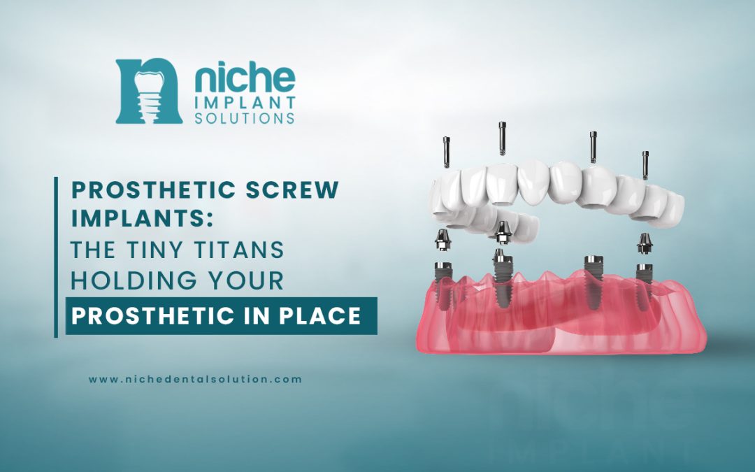   Prosthetic Screw Implants: The Tiny Titans Holding Your Prosthetic in Place