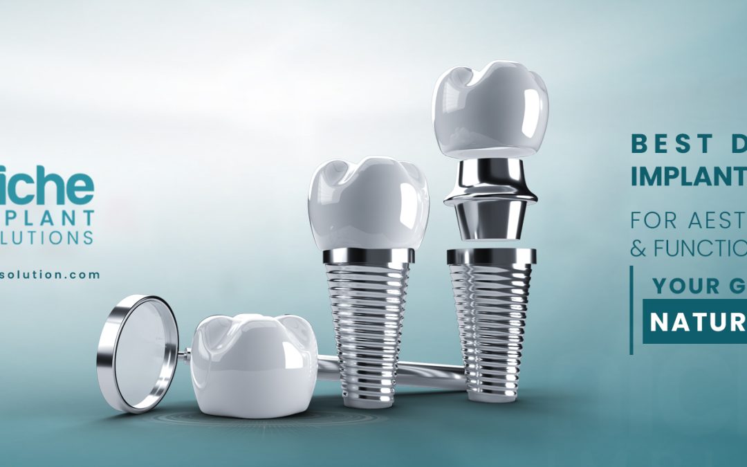 Best Dental Implant Brands for Aesthetics & Functionality : Your Guide to a Natural Smile