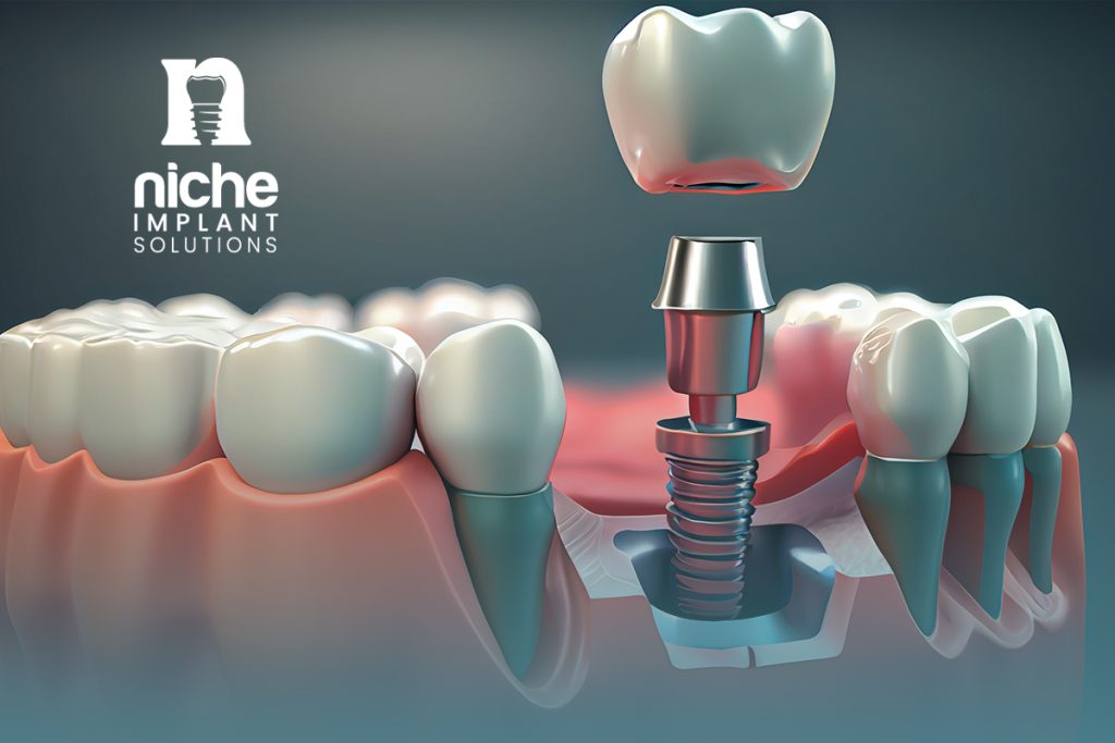 best type of dental implants