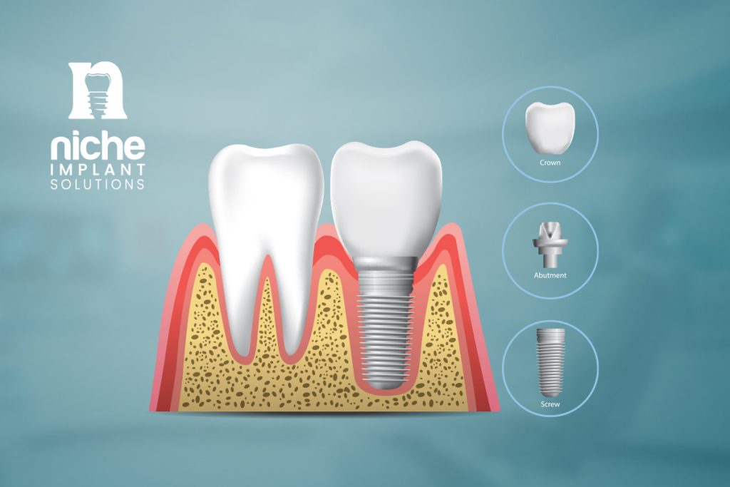 best type of dental implants