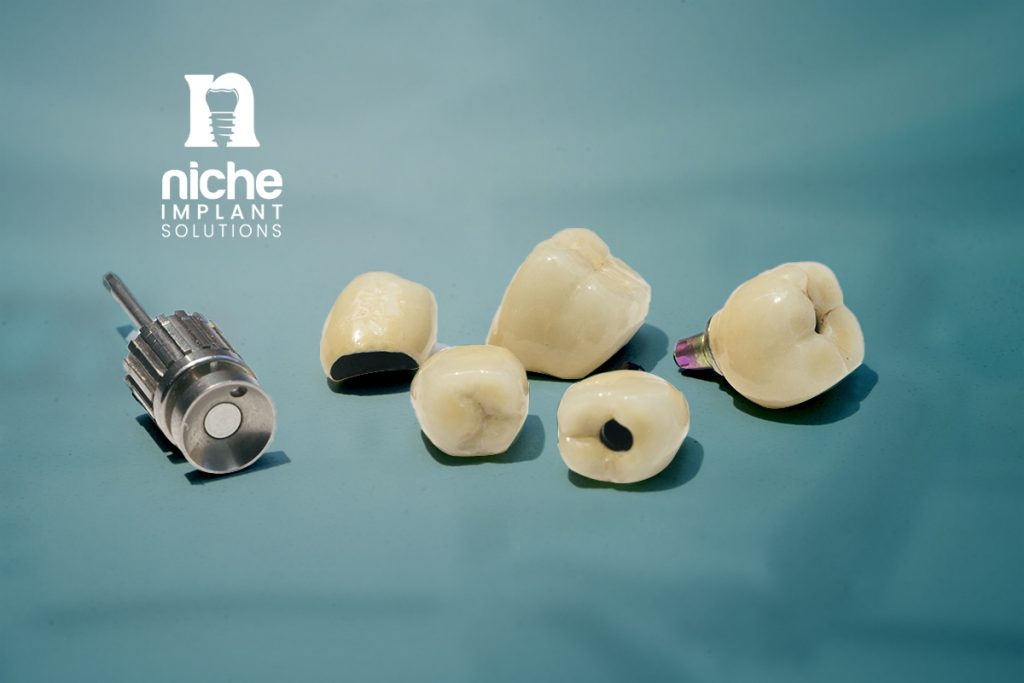 bredent dental implants | You can get it from Niche now