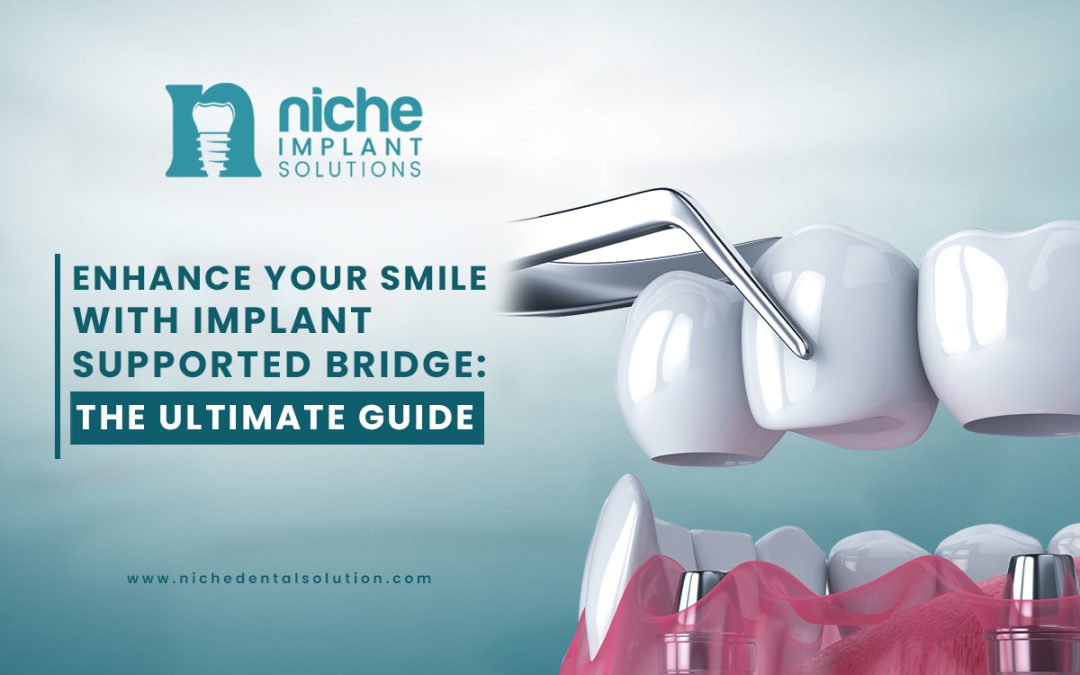  Enhance Your Smile with Implant Supported Bridge: The Ultimate Guide 