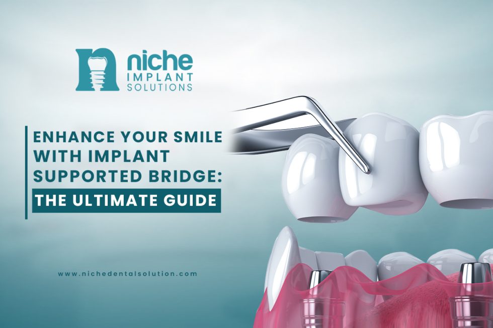 implant supported bridge | All you need get it from Niche