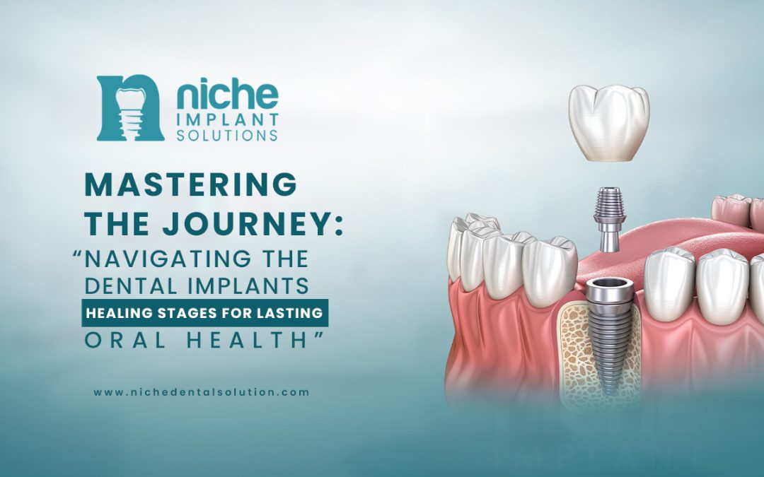 Mastering the Journey: “Navigating the Dental Implant Healing Stages for Lasting Oral Health”