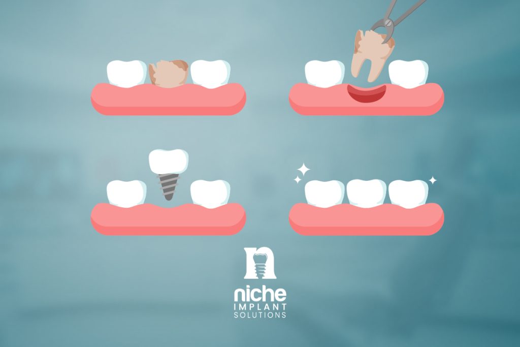 dental implant healing stages