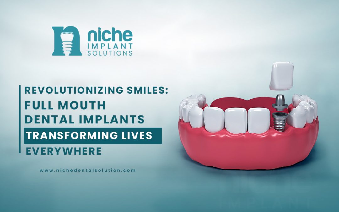 “Revolutionizing Smiles: Full Mouth Dental Implants Transforming Lives Everywhere”