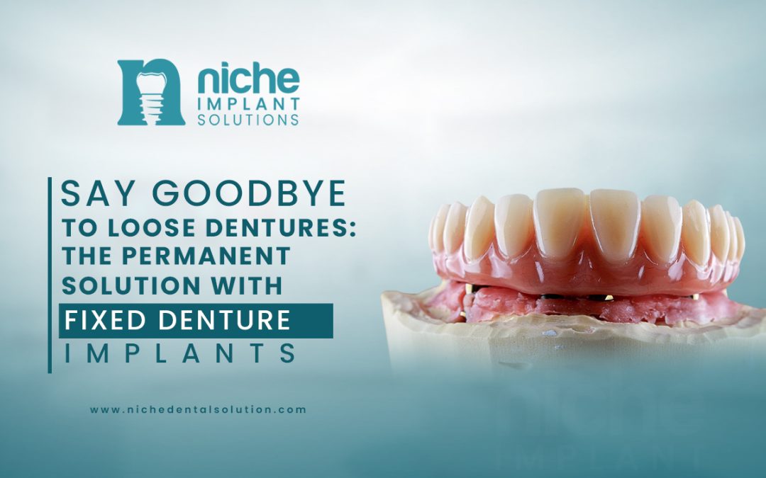 Say Goodbye to Loose Dentures: The Permanent Solution with Fixed Denture Implants