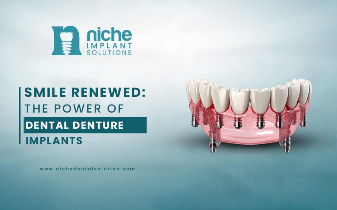 Smile Renewed: The Power of Dental Denture Implants