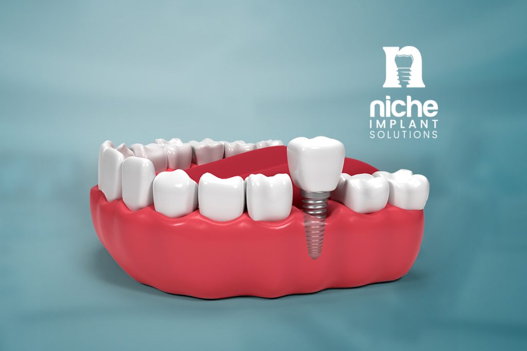 dental denture implants