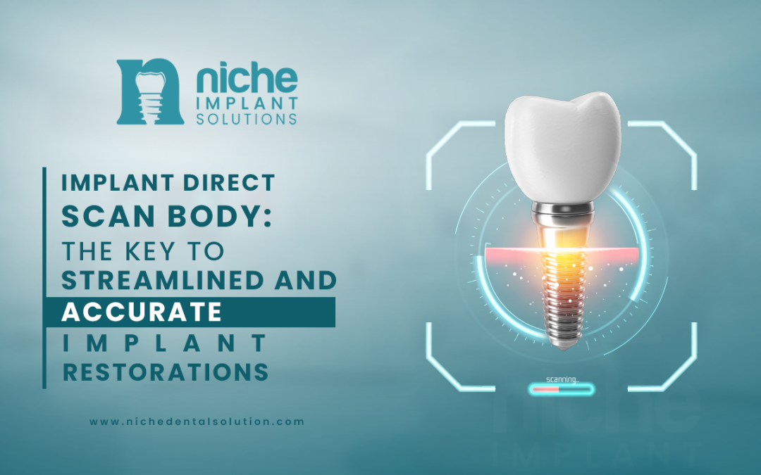 Implant Direct Scan Body: The Key to Streamlined and Accurate Implant Restorations