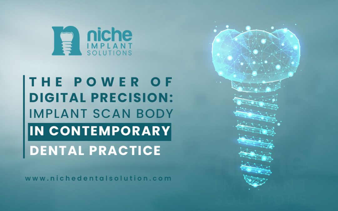 The Power of Digital Precision: Implant Scan Body in Contemporary Dental Practice