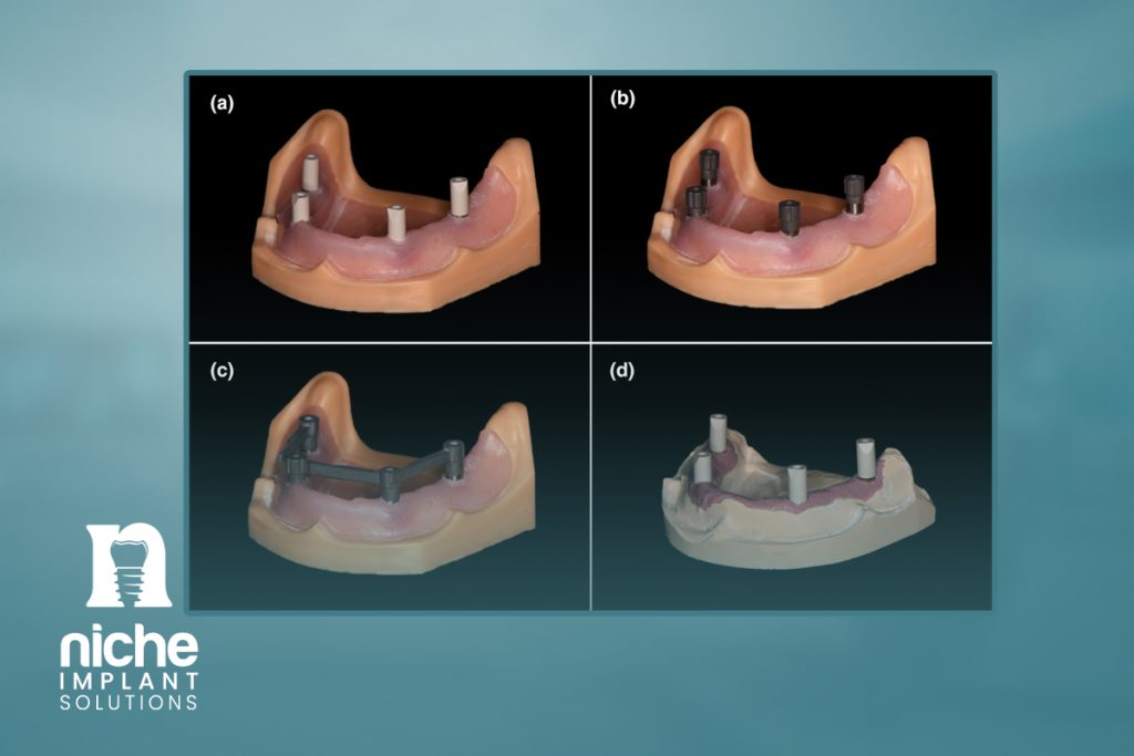 implant scan body