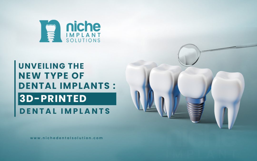 Unveiling the new type of dental implants : 3D-Printed Dental Implants