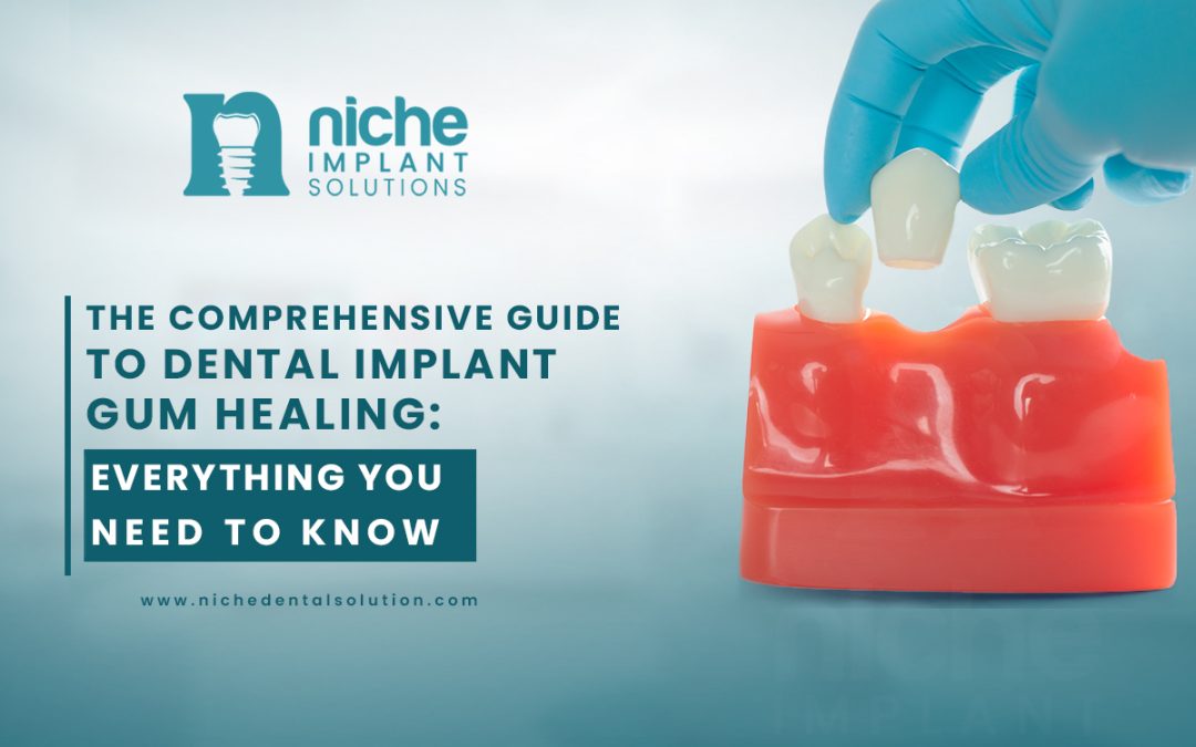 The Comprehensive Guide to Dental Implant Gum Healing: Everything You Need to Know