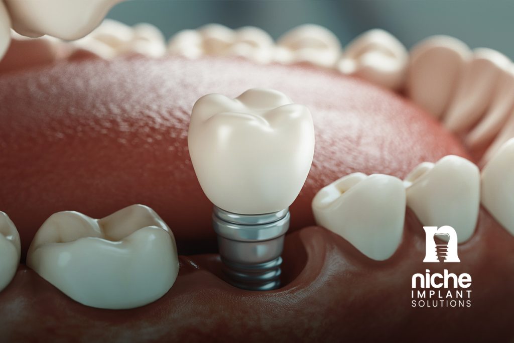 dental implant gum healing