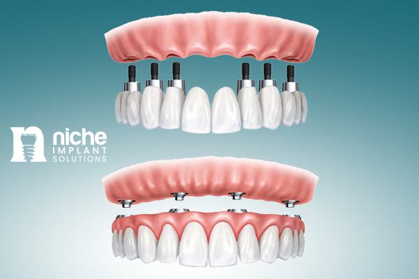 denture & implant solutions