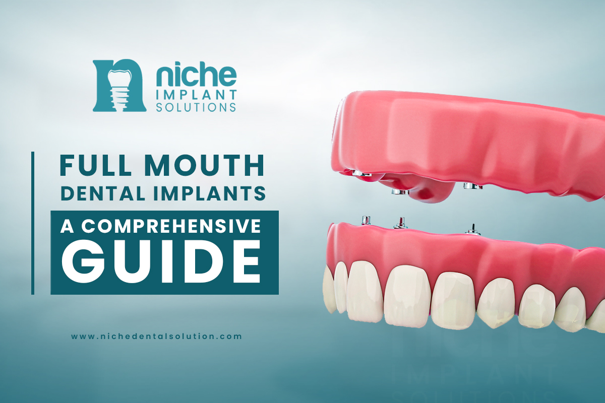 full mouth dental implant