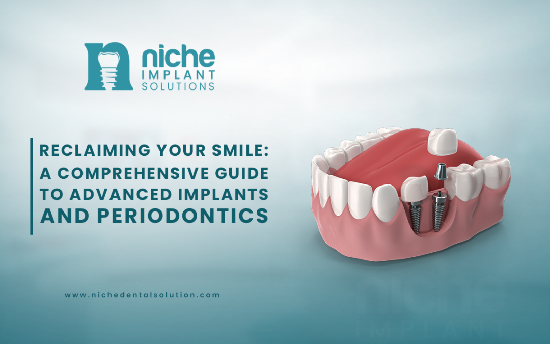 Reclaiming Your Smile: A Comprehensive Guide to Advanced Implants and Periodontics