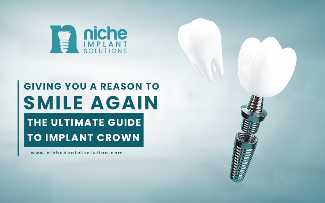 Giving You a Reason to Smile Again: The Ultimate Guide to Implant Crown