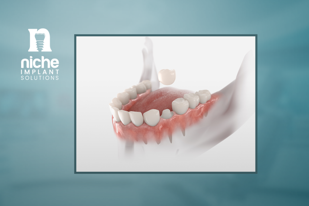 zirconia dental implants