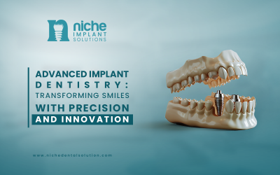 Advanced Implant Dentistry: Transforming Smiles with Precision and Innovation