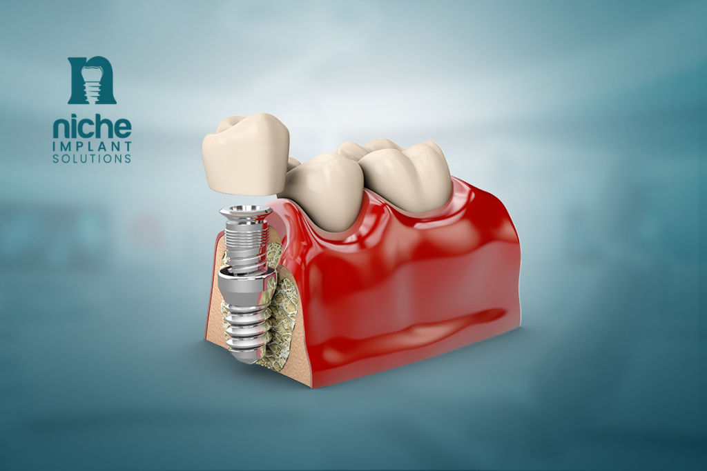 advanced implant dentistry