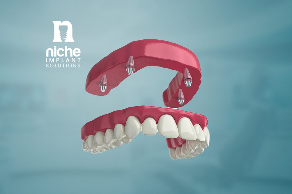 full mouth dental implant