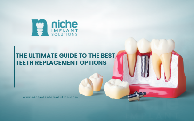 The Ultimate Guide to the Best Teeth Replacement Options