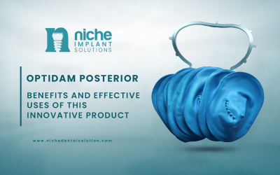 Optidam Posterior: Benefits and Effective Uses of This Innovative Product