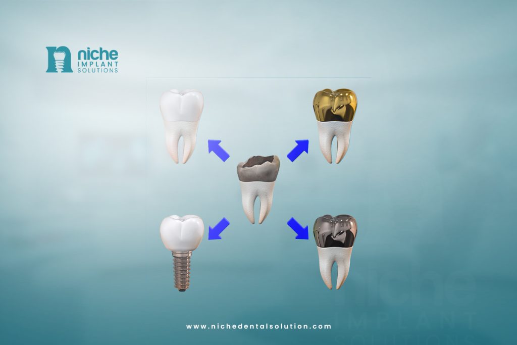 best option for dental implants