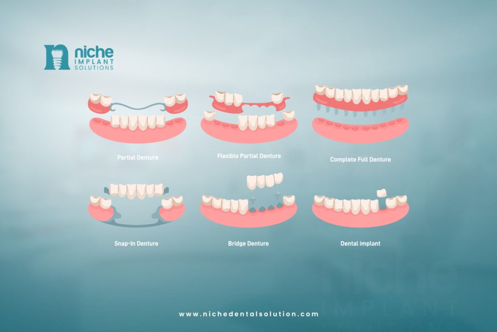 best option for dental implants