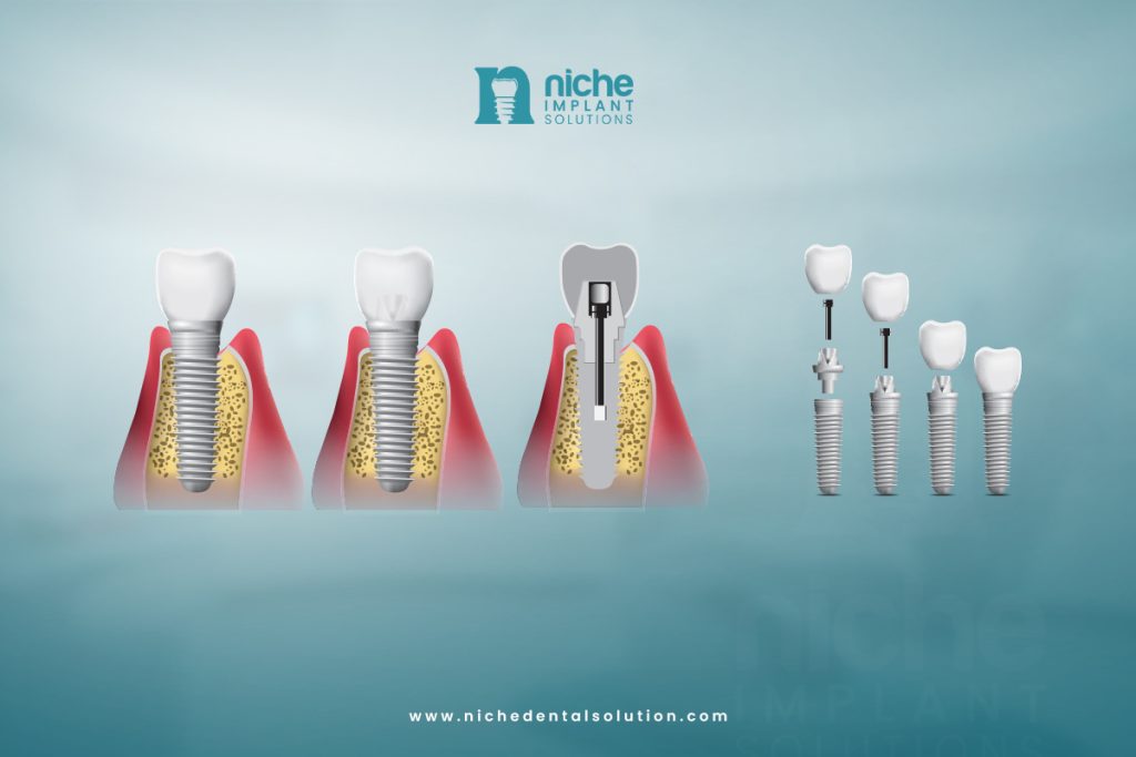 dental implant recovery timeline