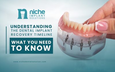 Understanding the Dental Implant Recovery Timeline: What You Need to Know