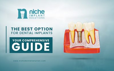 The Best Option for Dental Implants: Your Comprehensive Guide