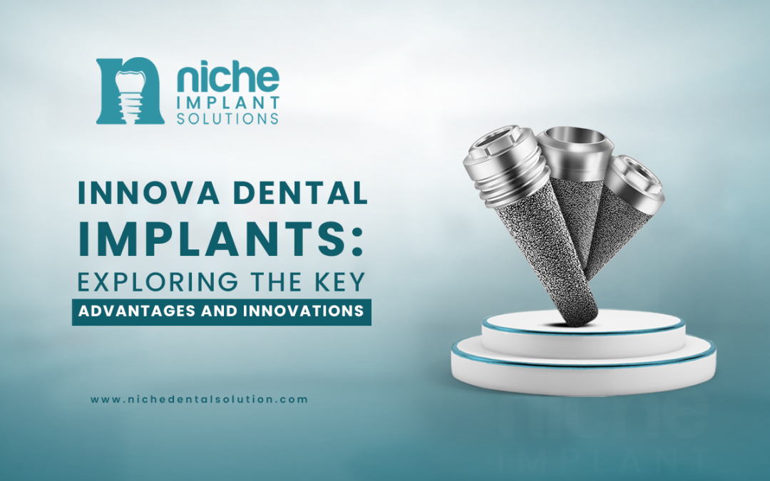 Innova Dental Implants: Exploring the Key Advantages and Innovations