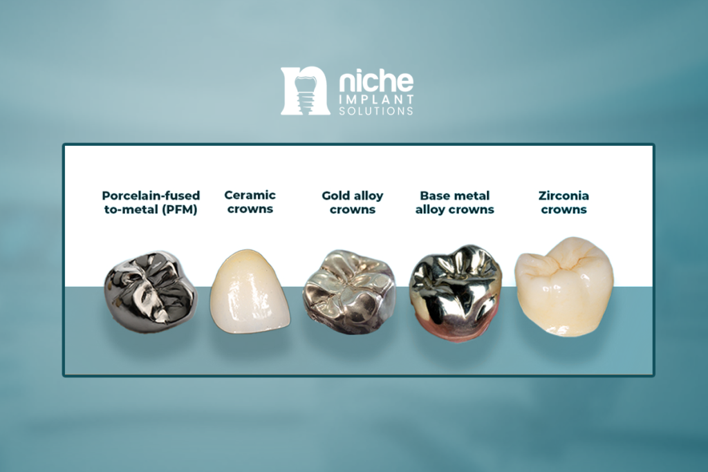 Biocompatible metals