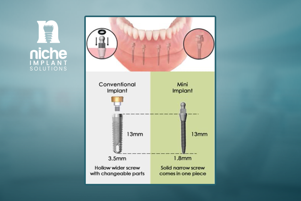 Mini dental implants