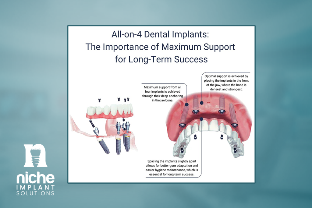 strongest dental implants