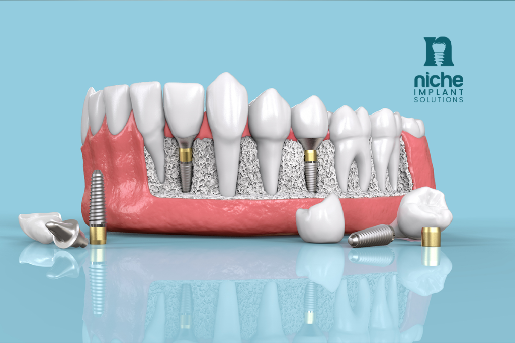 strongest dental implants