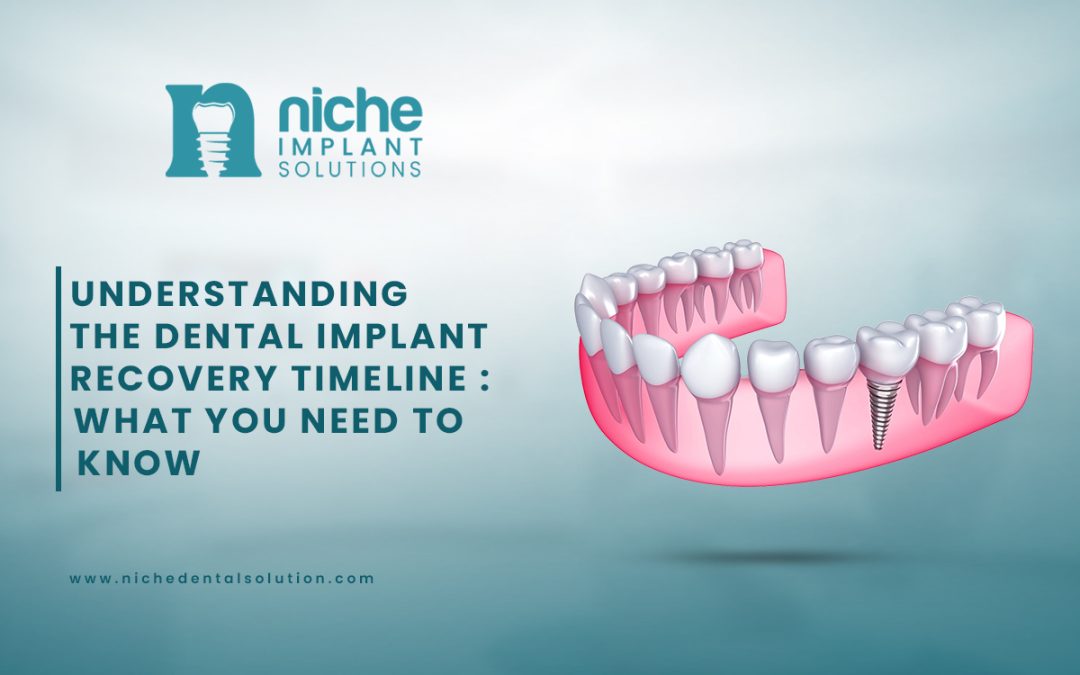 Essential Dental Implant Tips: Your Comprehensive Guide to a Successful Procedure