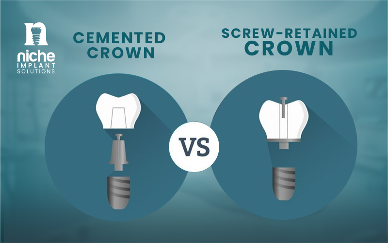 dental implant crown material