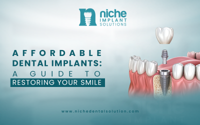 Affordable Dental Implants: A Guide to Restoring Your Smile