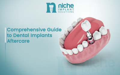 Comprehensive Guide to Dental Implants Aftercare