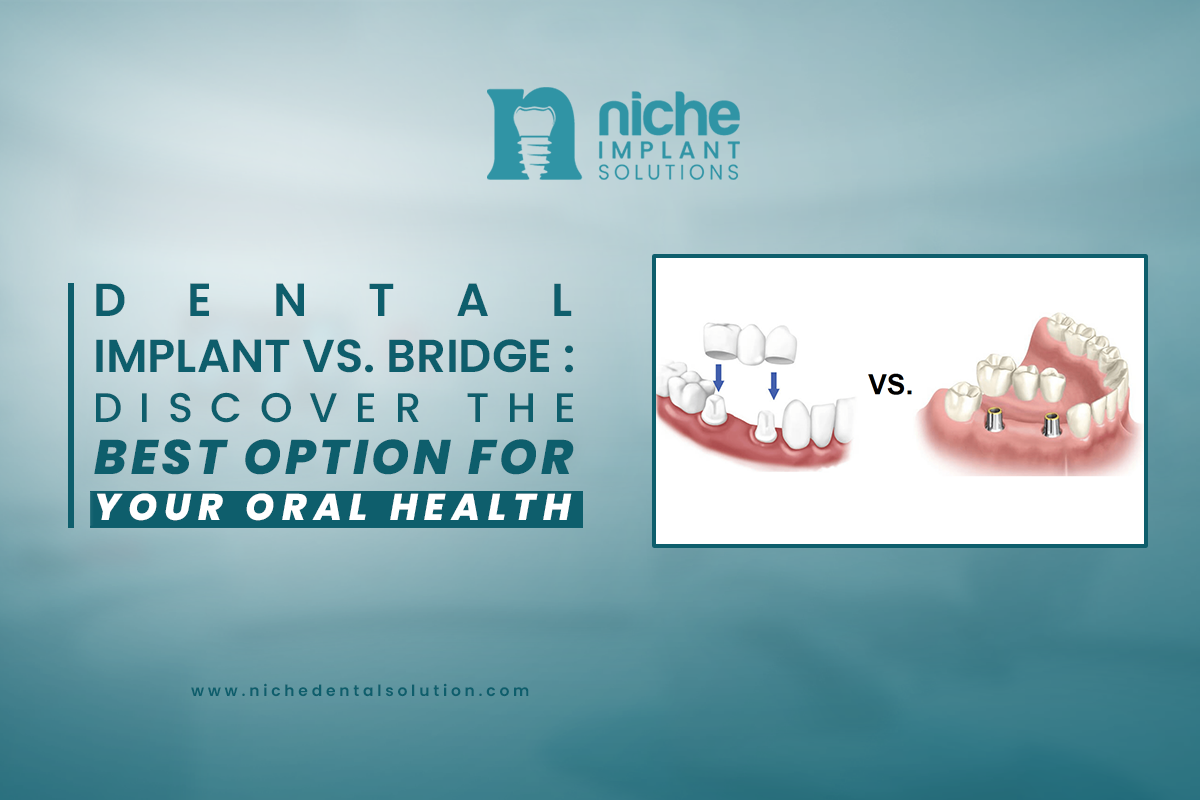 Dental implant vs. bridge