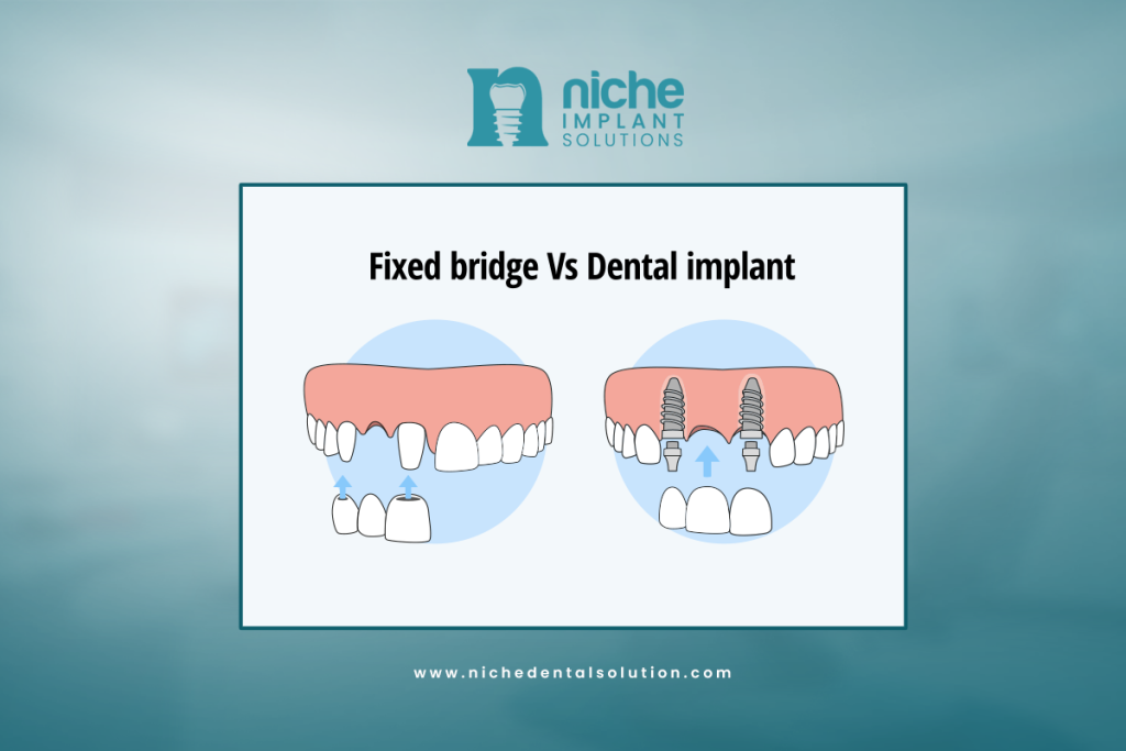 Dental implant vs. bridge