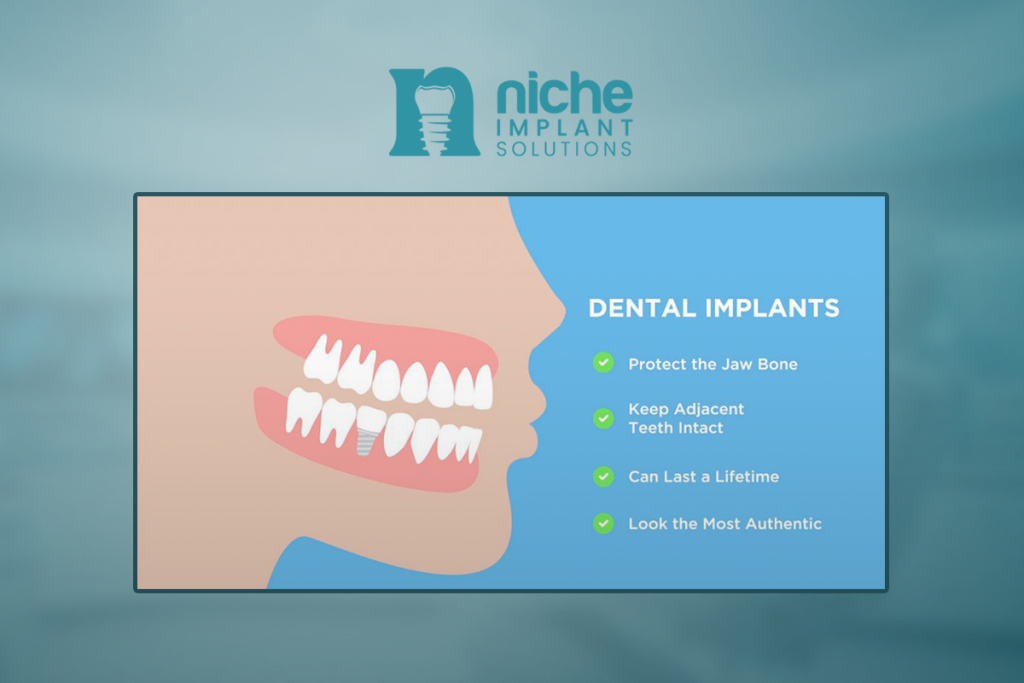 Dental implant safety