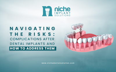 Navigating the Risks: Complications after Dental Implants and How to Address Them