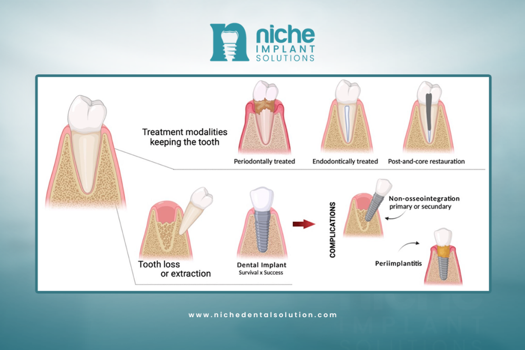 complications after dental implants