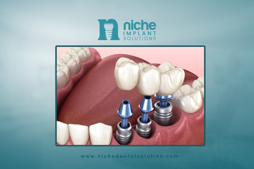 latest dental implant technology