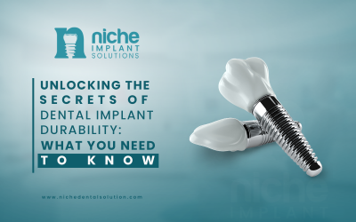 Unlocking the Secrets of Dental Implant Durability: What You Need to Know